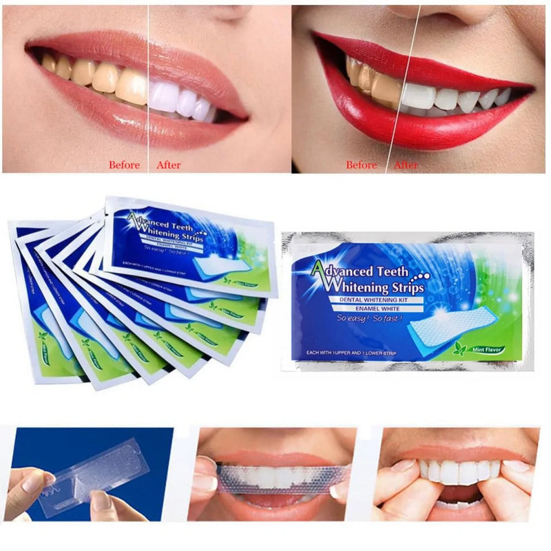 2-Pack 3D White Gel Teeth Whitening Strips for Daily Oral Hygiene Care